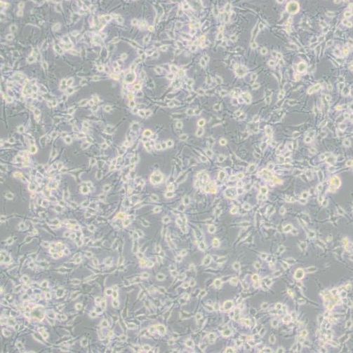 人乳腺癌细胞（MDA-MB-436）
