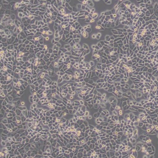 人乳腺癌细胞（MDA-MB-468）