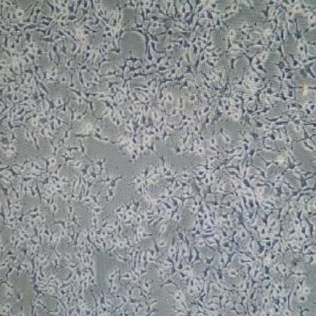 鸡肝癌细胞(LMH)