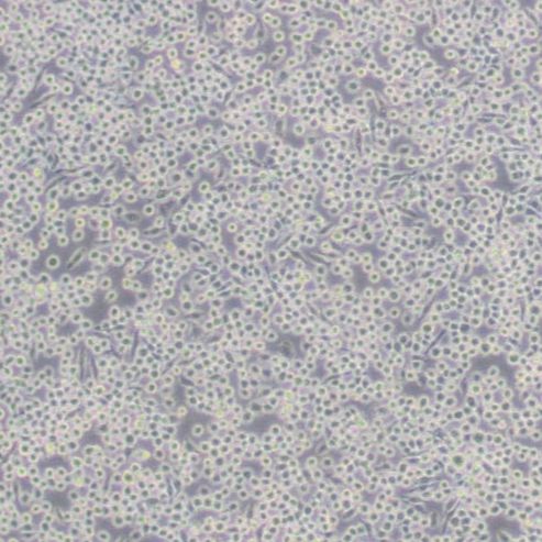 小鼠单核巨噬细胞(J774A.1)
