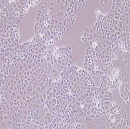 人胃癌细胞(MKN-28)