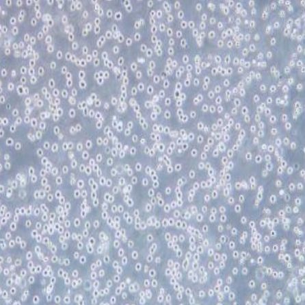 急性早幼粒细胞株（NB4）