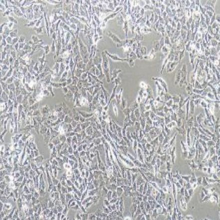 小鼠乳腺癌高转移细胞（MA-891）