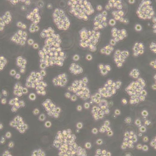 人T淋巴细胞白血病细胞 Jurkat（clone E6-1）