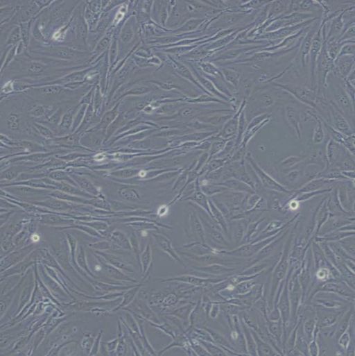 小鼠胰岛内皮细胞(MS1)