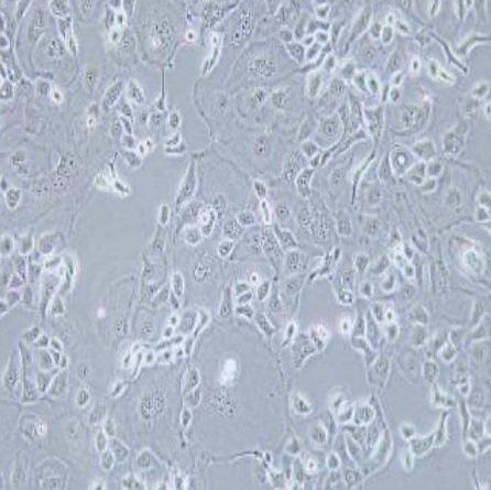 人子宫内膜癌细胞(KLE)