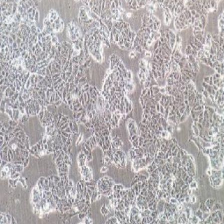 人乳腺癌细胞带荧光素酶(MCF-7+Luc)
