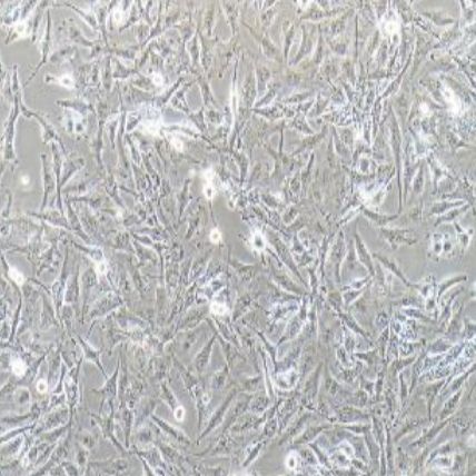 人胶质瘤细胞（SNB-19）