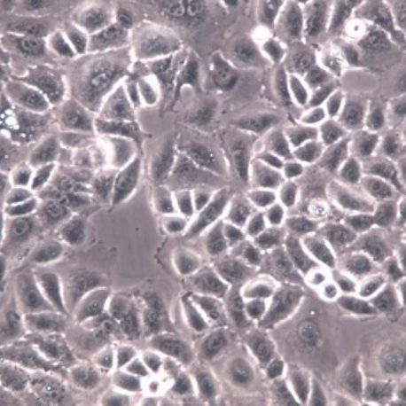 人胰腺导管腺癌细胞（PL45）