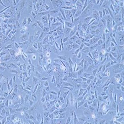 人低分化肺腺癌细胞(SK-LU-1)