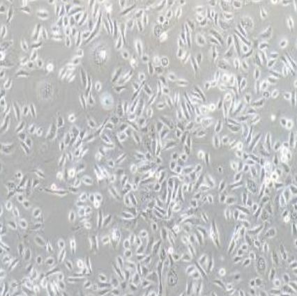 人前列腺正常细胞（RWPE-2）