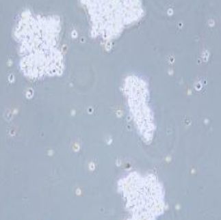 人小细胞肺癌细胞（SHP-77）