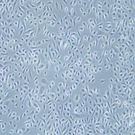 人前列腺正常细胞（RWPE-1）