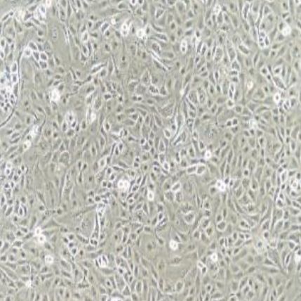 云南宣威肺腺癌细胞系（XWLC-05）
