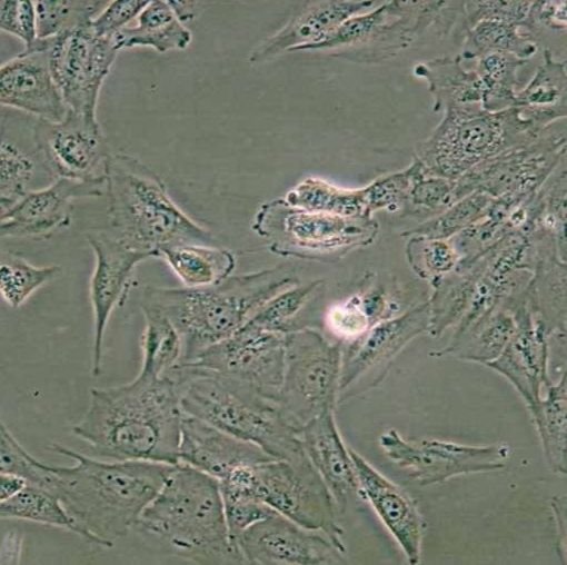 人正常前列腺基质永生化细胞(WPMY-1)
