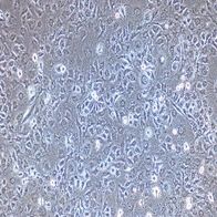人胶质瘤细胞（SHG44)