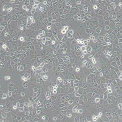 人卵巢癌细胞[OVCAR-3 (OVCAR3)]