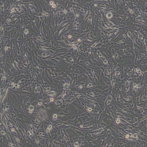 人类星型胶质细胞瘤(U251MG)