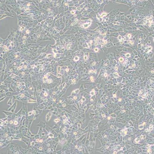 大鼠骨肉瘤细胞（UMR-106）