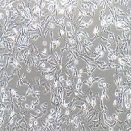 人类星型胶质细胞瘤TMZ耐药株(U251/TMZ)