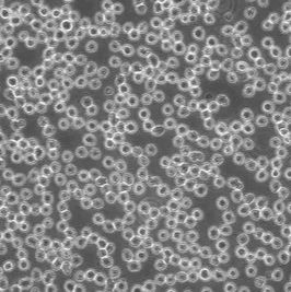 小鼠白血病细胞（M1)