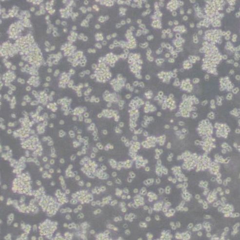 小鼠淋巴瘤细胞（YAC-1）