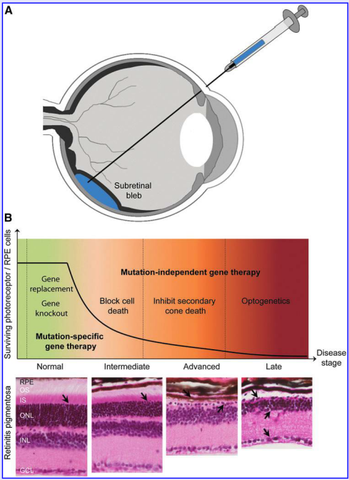 AAV 在眼科中应用研究