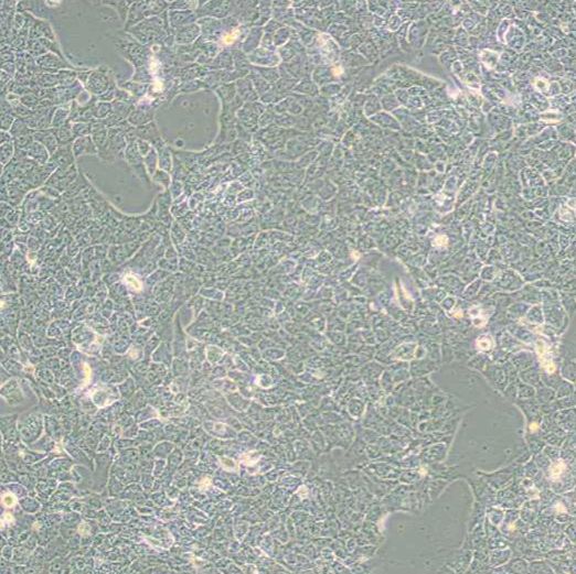 人肺癌细胞（NCI-H2228）
