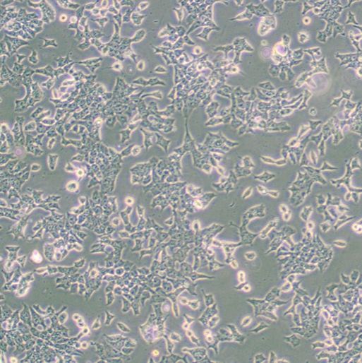 小鼠畸胎瘤细胞（P19）
