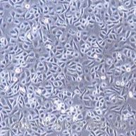 小鼠B细胞淋巴瘤（A20）