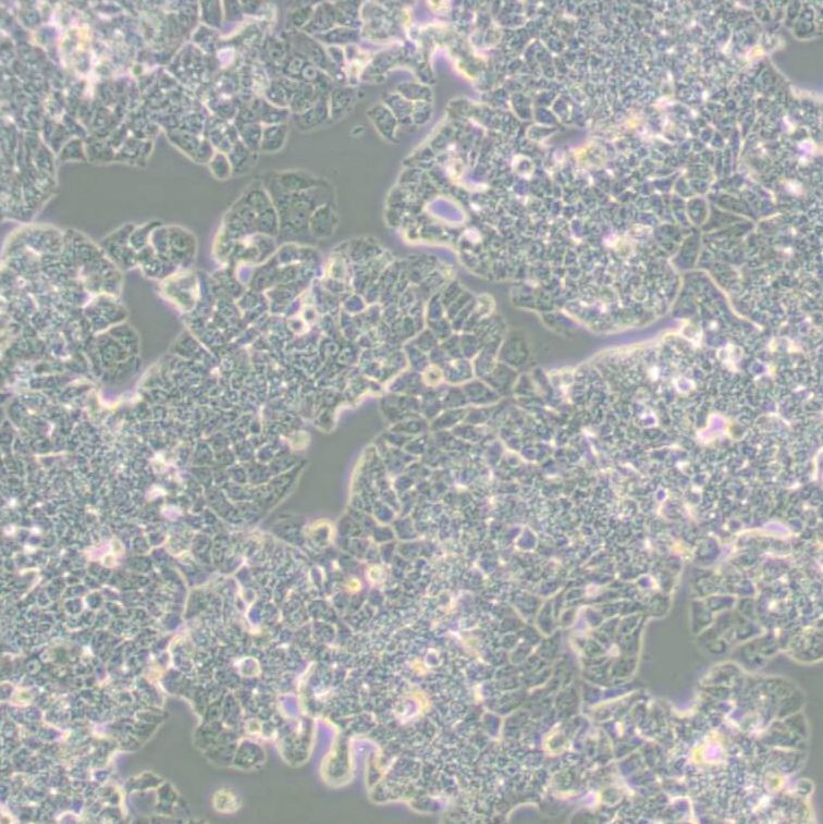 人乳腺导管癌细胞（T47D）