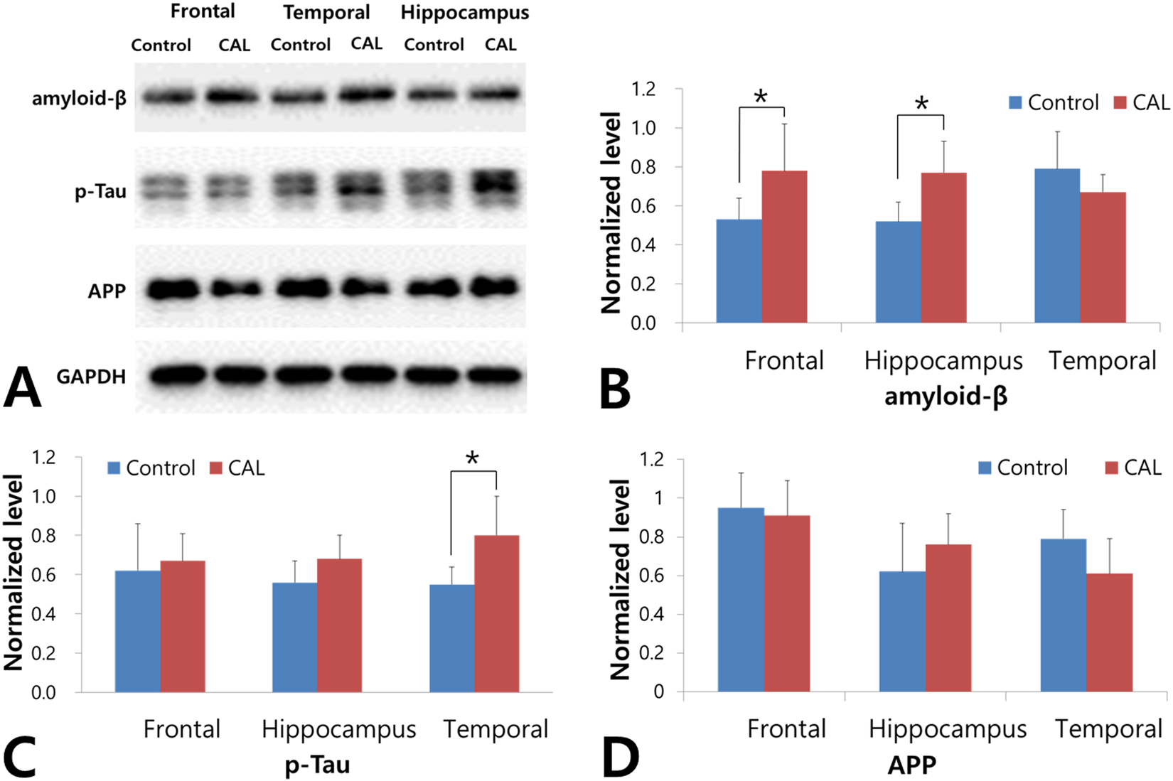 研究进展-慢性脑缺血(CCH)对阿尔茨海默病(AD)病理及脑葡萄糖代谢影响