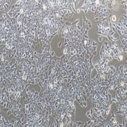 大鼠肝癌细胞（CBRH-7919）