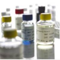 Human  CTX-I  ELISA人血清I型胶原C末端肽试剂盒  AC-02F1 现货