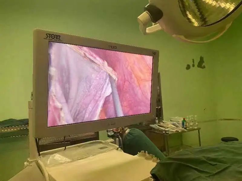 河南信合医院成功完成罕见巨大黏液性囊腺瘤切除术
