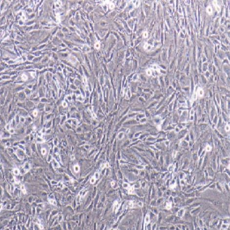 鼠肝星形细胞（CFSC-8B）