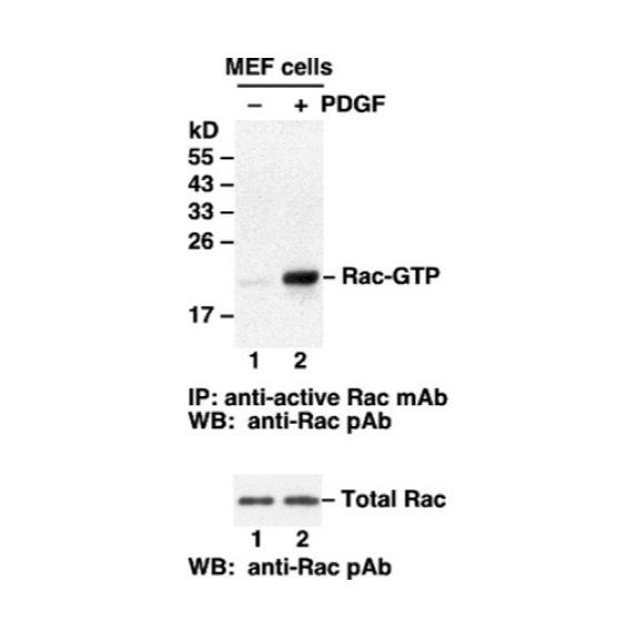 Anti-Rac1-GTP Monoclonal Antibody/2023文献更新