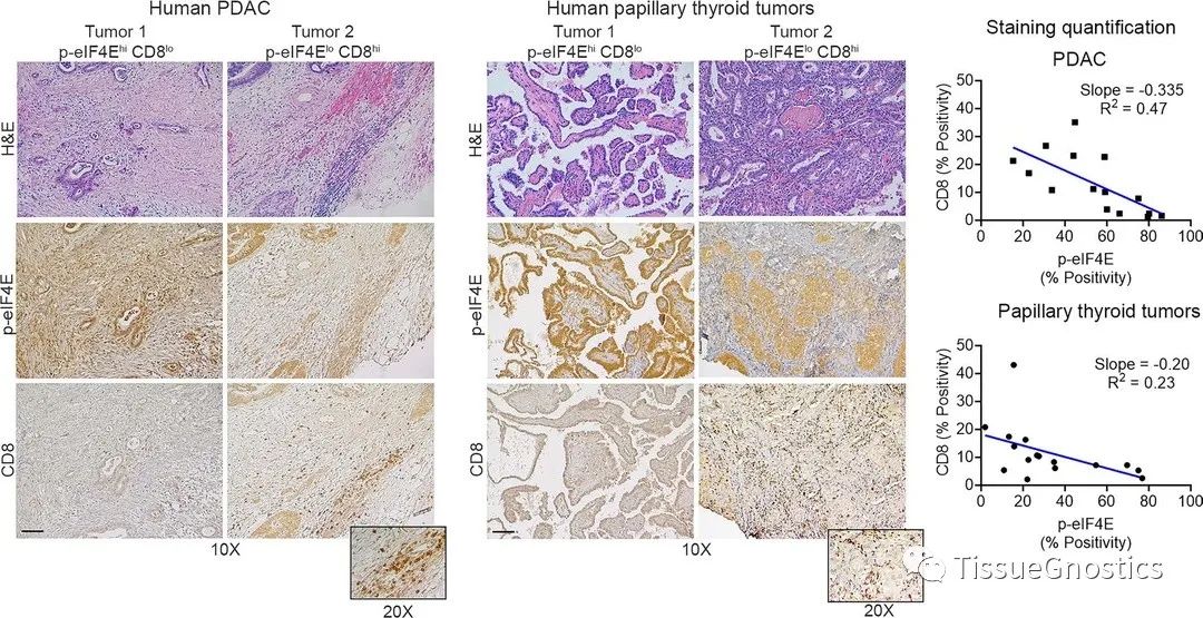 JCI Insight| 通过巨噬细胞调控CD8+T 细胞肿瘤免疫的新机制