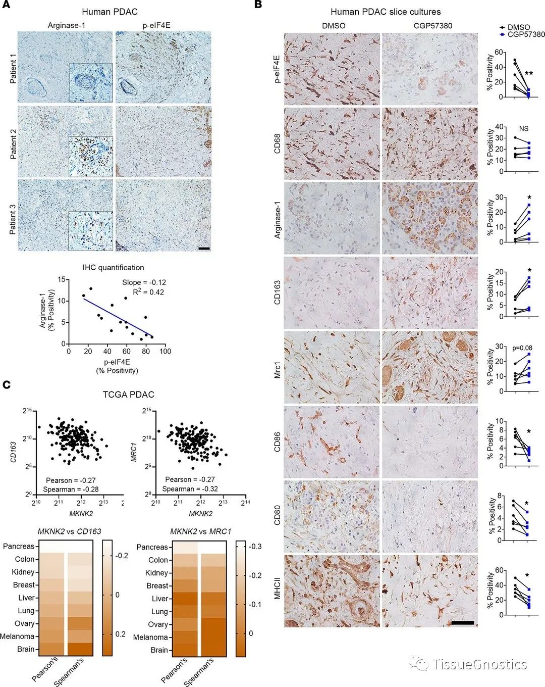 JCI Insight| 通过巨噬细胞调控CD8+T 细胞肿瘤免疫的新机制
