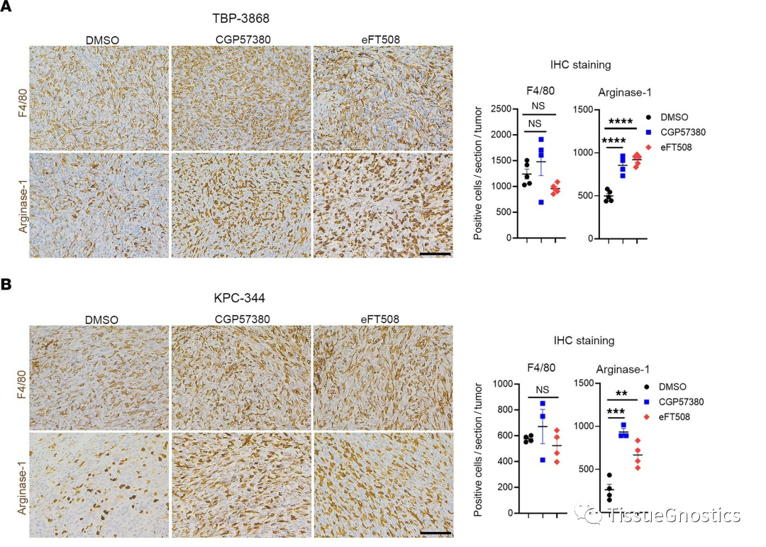 JCI Insight| 通过巨噬细胞调控CD8+T 细胞肿瘤免疫的新机制