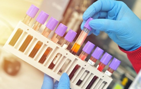 分述ELISA实验各种样本处理方法