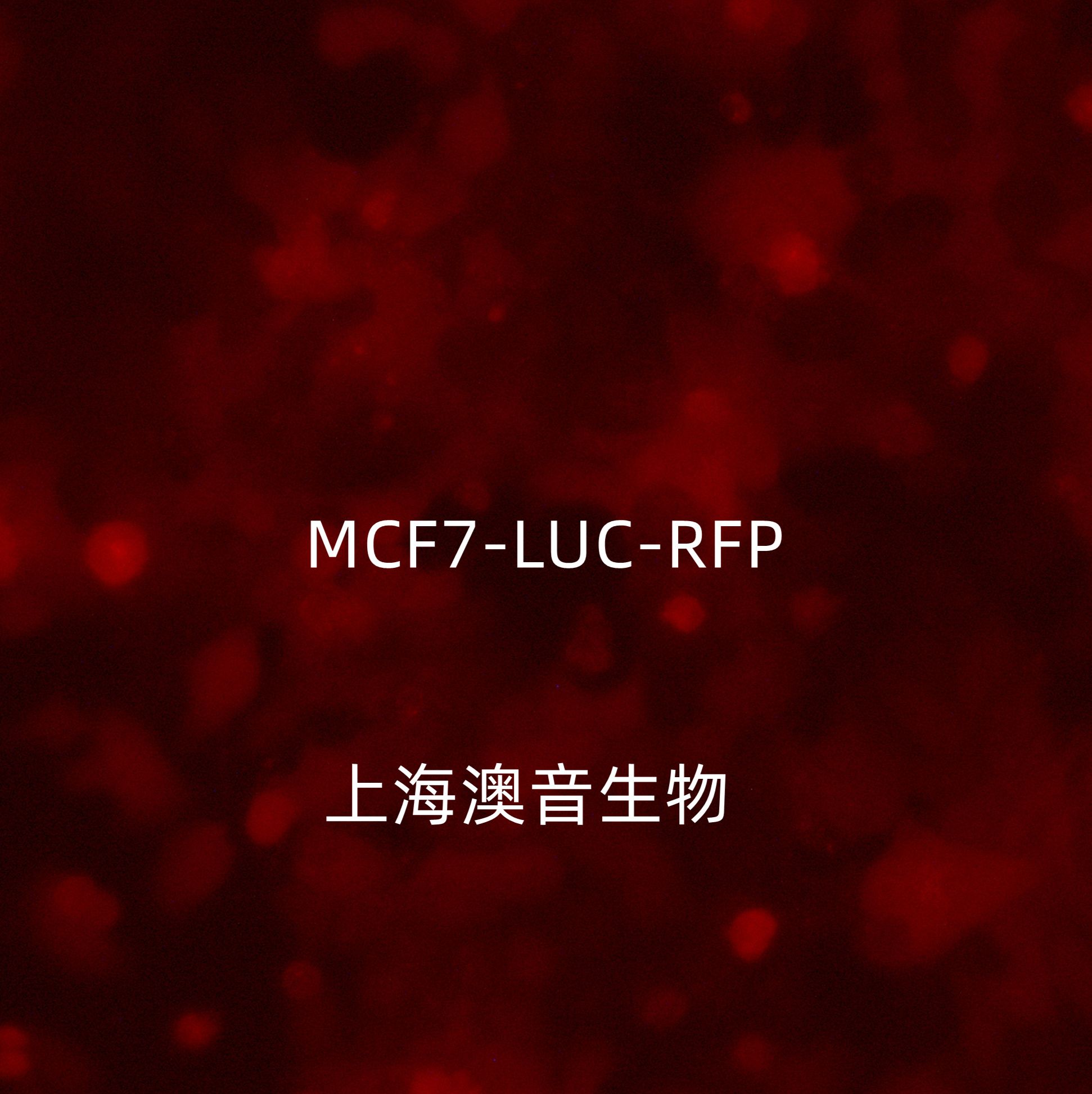 MCF-7-RFP-Puro[mcf7-rfp]rfp的人乳腺癌细胞