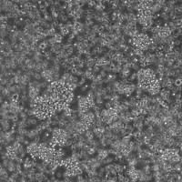 NCI-H3255人肺癌细胞