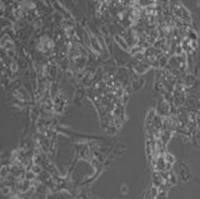 Hep G2人肝癌细胞