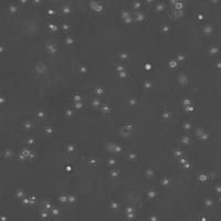OCI-LY10人弥漫大B细胞淋巴瘤细胞