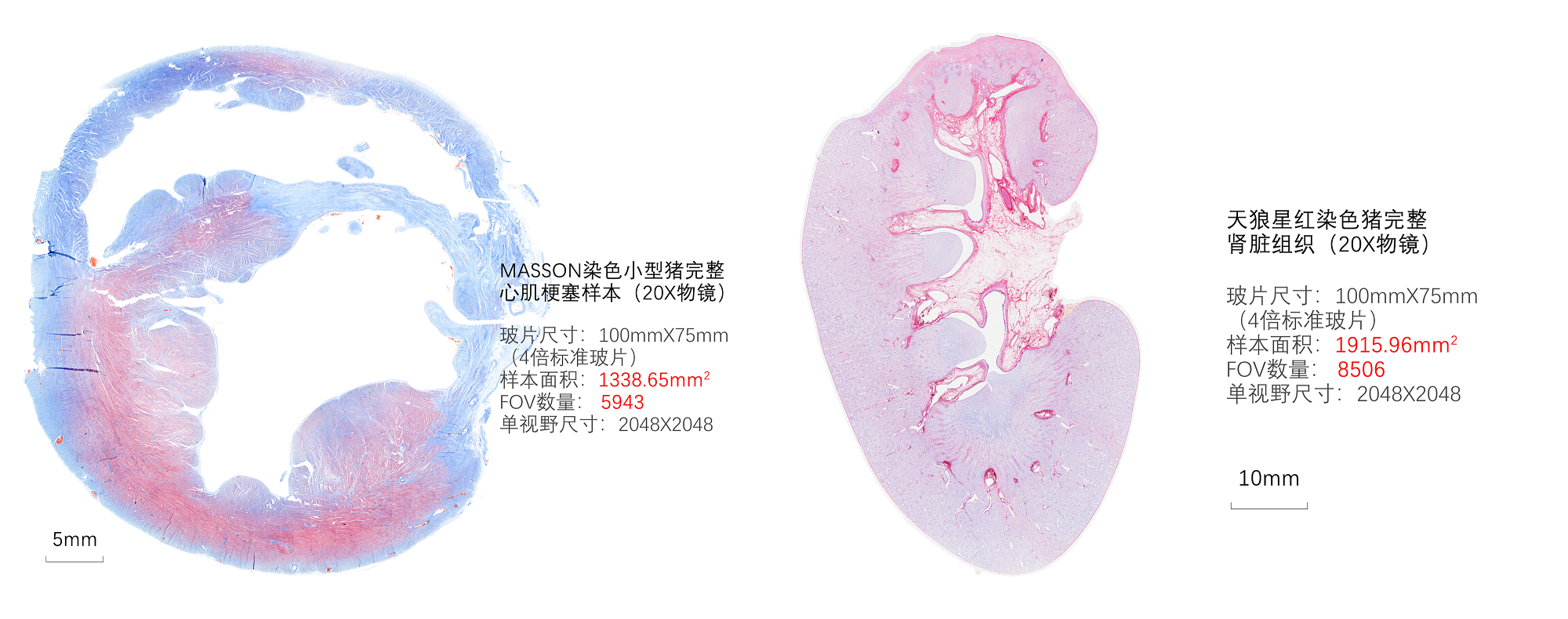 浅析精准组织识别与单细胞定量分析的重要性