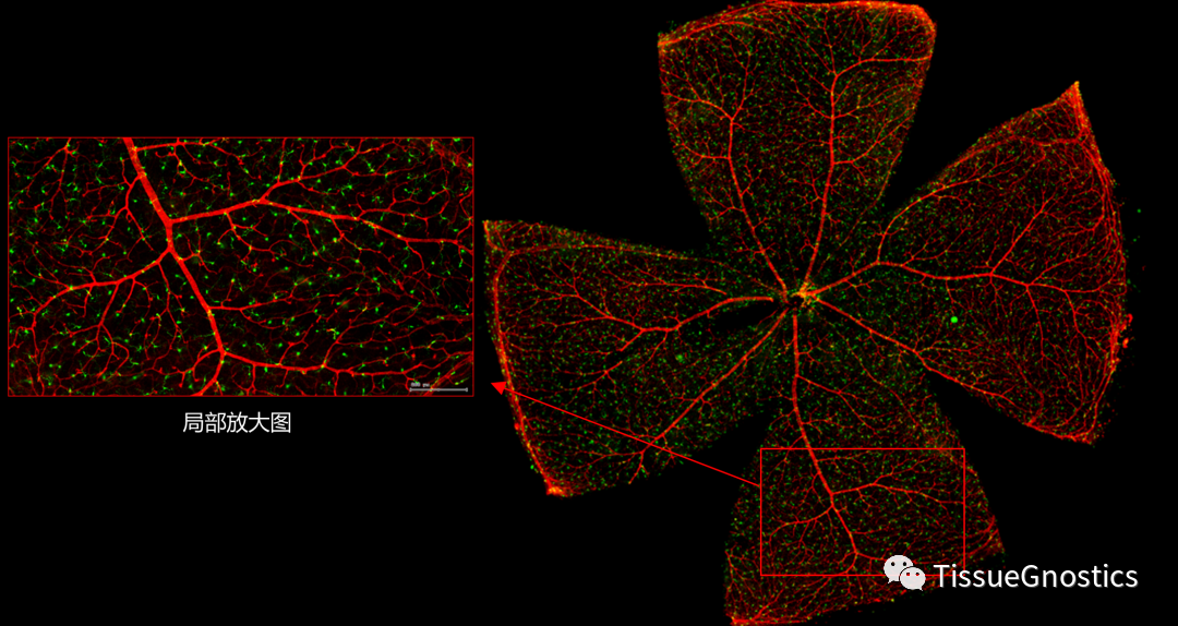 TissueGnostics带您解读视网膜组织形态学特征及多种结构定量