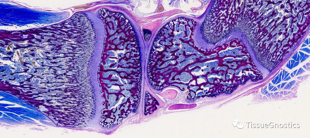 案例|Tissue Cytometry全景超大尺寸组织流式定量分析技术在骨组织方向研究