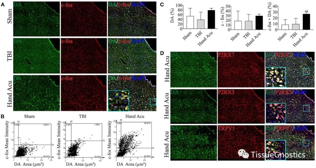 手十二井穴刺络调节嘌呤能受体P2RX7蛋白改善创伤性脑损伤引起的昏迷