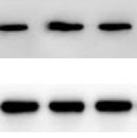 Western Blotting 技术服务